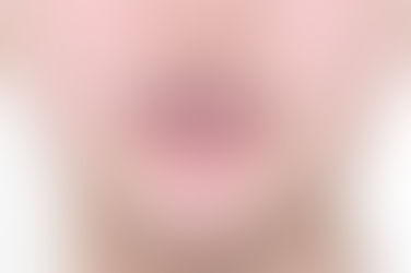 부산덧니교정