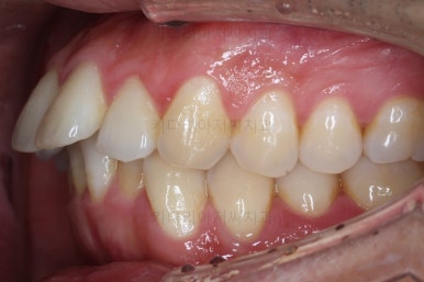 부산교정치과추천