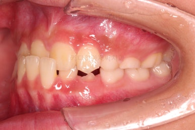 부산어린이교정