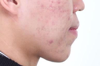부산교정과전문의