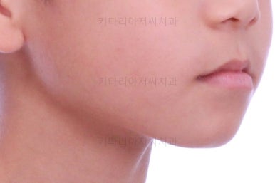 부산어린이교정