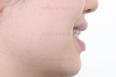 부산교정치과