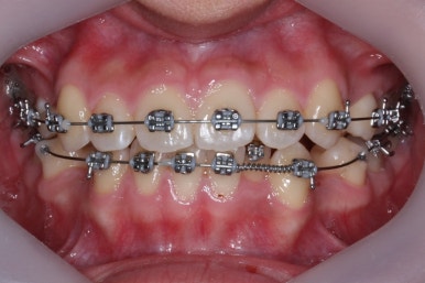 부산교정전문의