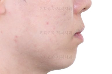 부산교정치과