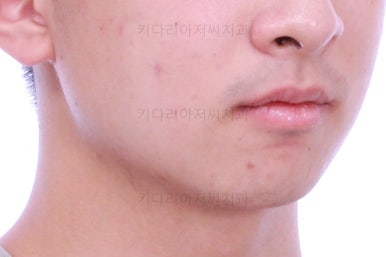 부산교정치과추천