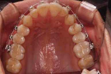 부산연제구교정