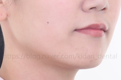 부산인비절라인