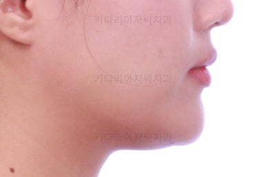 연산동치아교정치과