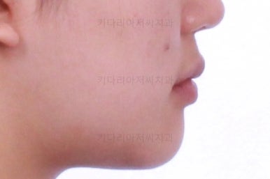 사직동교정치과