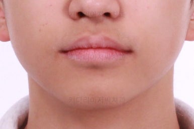 부산교정치과추천