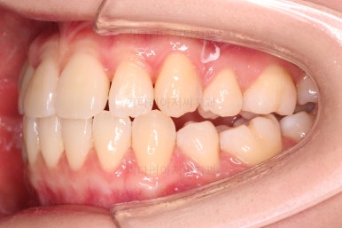 부산교정전문의