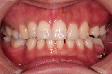 부산인비절라인