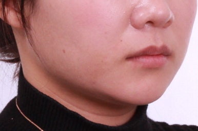 부산치아교정치과