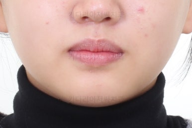 부산교정전문의