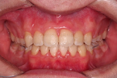 부산교정치과추천