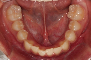 부산연산동청소년교정