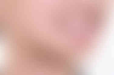 부산치아교정전문의