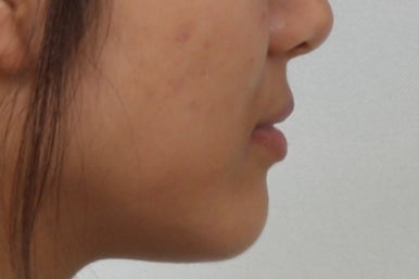 부산연산동청소년교정