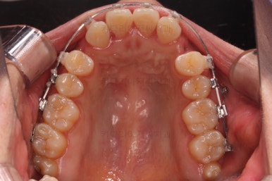 연산동교정치과