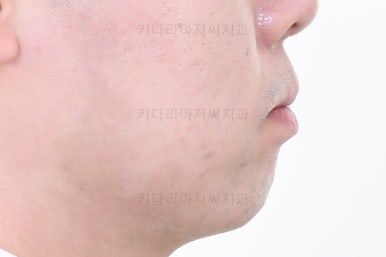 부산교정치과