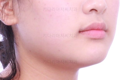 부산교정치과추천