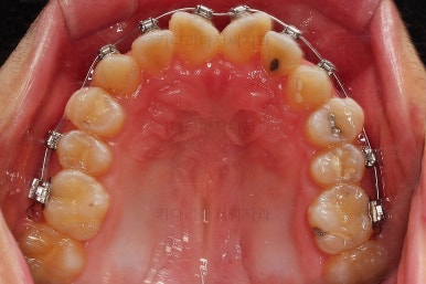 부산교정치과추천