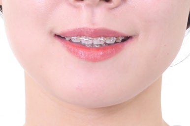 부산연산동교정치과