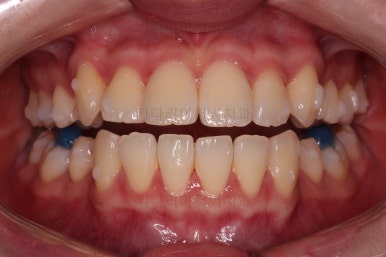 부산교정전문의