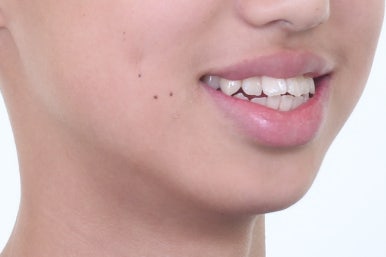 부산치아교정전문의