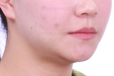 부산교정전문의