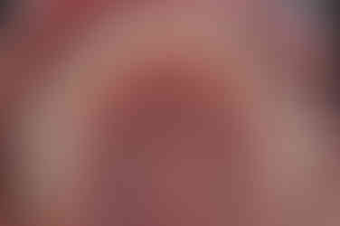 부산왜소치교정