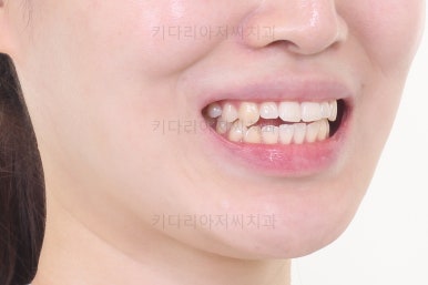 부산교정치과