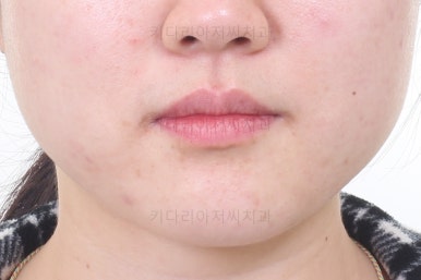 부산인비절라인