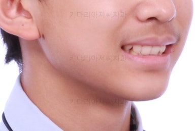 부산교정치과추천