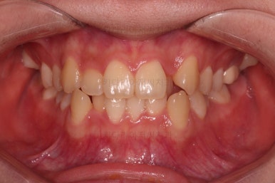 동래구치아교정