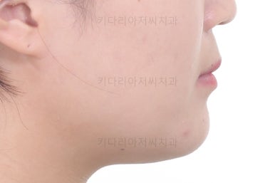 부산치아교정치과