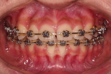 부산치아교정치과