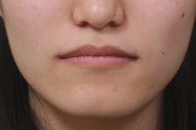 부산교정전문의