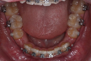 부산교정전문의