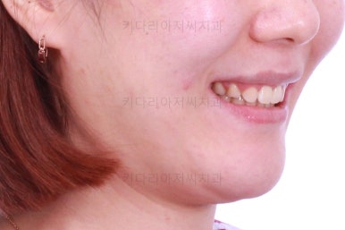 연산동교정치과