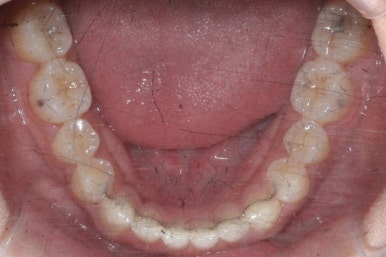 부산치아교정치과