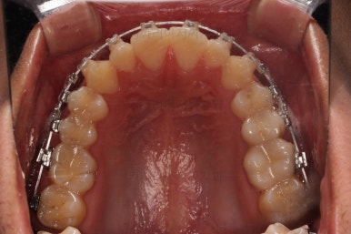 부산연제구교정
