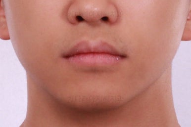 부산교정치과추천