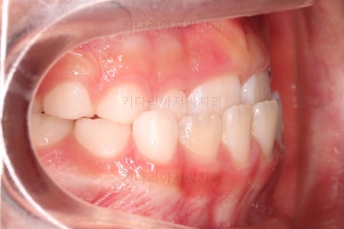 부산어린이교정