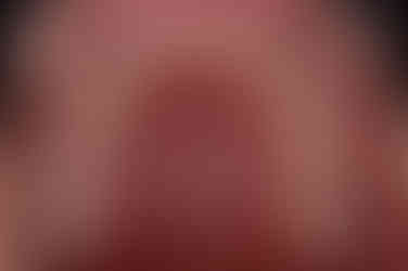 부산치아교정잘하는곳