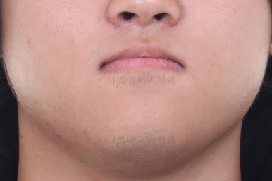 연산동교정