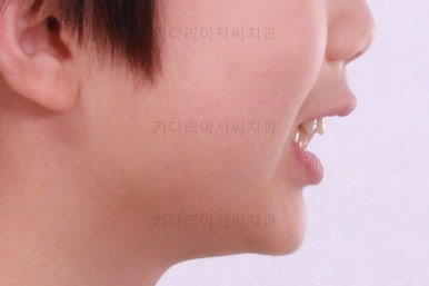부산어린이교정