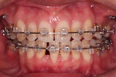 부산재교정치과