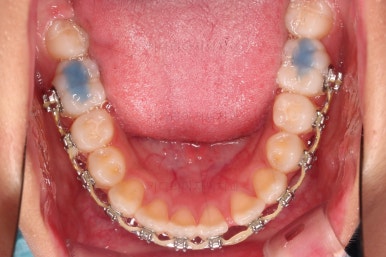 부산치아교정치과