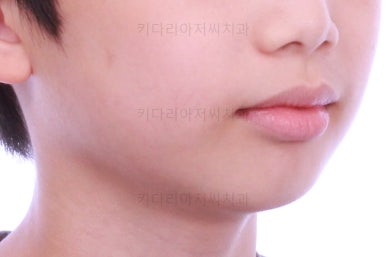 부산어린이교정